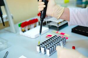Scientists hands with dropper or pipette photo
