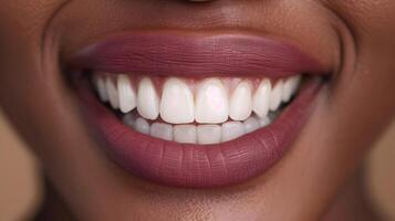 AI generated Radiant Black Womans Perfect Smile with White Teeth on Flat Background photo