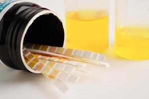 Urinalysis, urine cup with reagent strip pH paper test and comparison chart in laboratory. photo