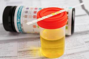 Urinalysis, urine cup with reagent strip pH paper test and comparison chart in laboratory. photo