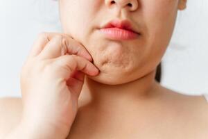 A woman with a puffy face and double chin. photo