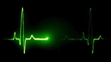 Herz Festnahme auf das medizinisch Monitor, Herz stoppt Prügel video