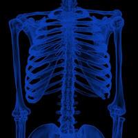 X-ray Vision,of the Human Body and Bones. photo