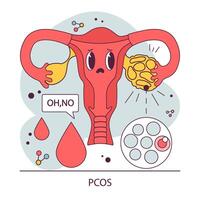 pcos, poliquístico ovario síndrome. hembra reproductivo sistema. endocrino vector