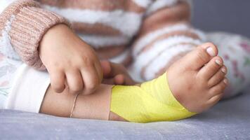 Elastic therapeutic yellow tape applied to child leg. Kinesio Taping therapy for injury video