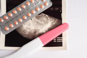 Pregnancy test and birth control pills with ultrasound scan of baby uterus, contraception health and medicine. photo