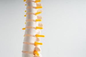 Lumbar spine displaced herniated disc fragment, spinal nerve and bone. Model for treatment medical in the orthopedic department. photo