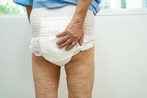 Asian senior woman patient wearing incontinence diaper in hospital, healthy strong medical. photo