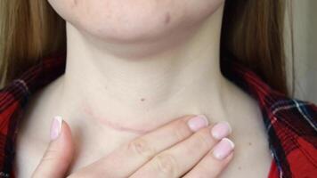 scar after surgery on woman neck video