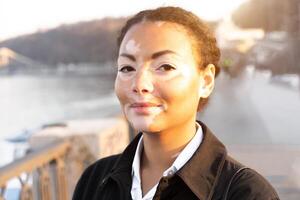 A beautiful young girl of African ethnicity with vitiligo standing on the warm spring city street dressed black coat photo