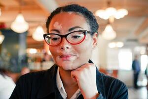 A beautiful young girl of African ethnicity with vitiligo sitting in a restaurant photo