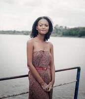 beautiful young brunette woman with vitiligo disease photo