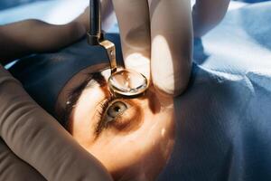 Vision correction with microscope. Surgeon's hands in gloves performing laser eye vision correction. ophthalmology , medicine, people health concept photo