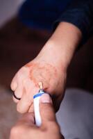 curación con un alérgico reacción crema en el mano. foto