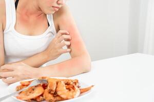 food allergies, women have reactions itching and redness after eating shrimp, seafood allergy, itching, rash, abdominal pain, diarrhea, chest tightness, unconsciousness, death, severe avoid allergies photo