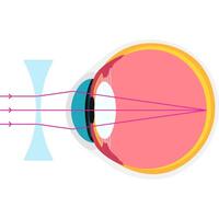 shortsighted academic diagram structure anatomy vector