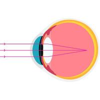 shortsighted academic diagram structure anatomy vector