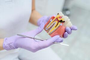 The concept of diagnosis and treatment of tooth disease. Doctor shows a model of a sick tooth. photo