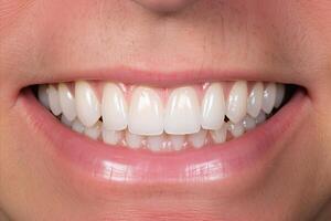 AI generated Achieve a radiant smile. professional teeth whitening services for a confident look photo