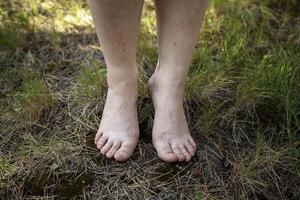 Woman's feet in the grass photo