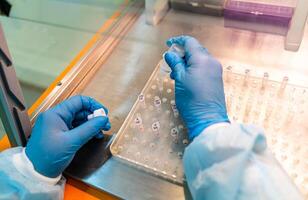 especial análisis en laboratorio. asistente en guantes recepción bio resultados. foto