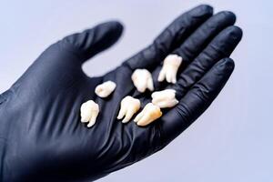 Ceramic dental implants. photo