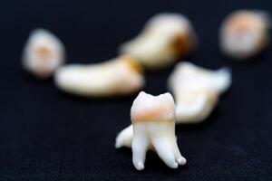Beautiful ceramic teeth on the front view. Blurred background. Black background. photo