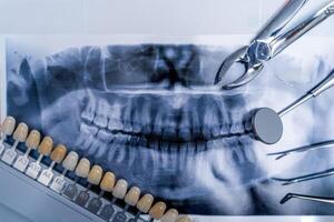 Dental pan x-ray, denture and dental instruments. Stomatology concept. photo