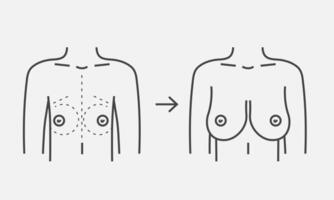 Female breast before and after augmentation line icon. Plastic surgery breast size correction. Vector illustration