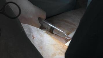 insertion une aiguille en dessous de le peau de le patient corps. action. proche en haut de chirurgien dans gants fabrication un injection. video