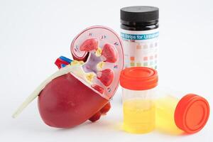 Urinalysis, Kidney and urine cup for check health examination in laboratory. photo