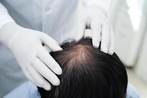 médico toque negrita cabeza en hombre, pelo pérdida tratamiento salud problema. foto