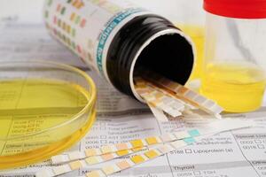 Urinalysis, urine cup with reagent strip pH paper test and comparison chart in laboratory. photo