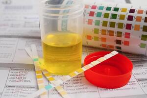 Urinalysis, urine cup with reagent strip pH paper test and comparison chart in laboratory. photo