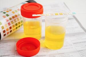 Urinalysis, urine cup with reagent strip pH paper test and comparison chart in laboratory. photo