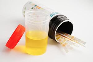 Urinalysis, urine cup with reagent strip pH paper test and comparison chart in laboratory. photo