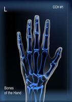 Frontal view x ray of bones the of hand. vector