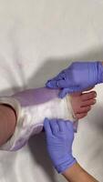 Hands of a doctor in blue gloves on a white background skillfully remove a plaster cast and a fixing bandage from an injured leg. video