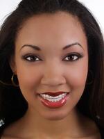 Smiling young black woman with braces upper teeth photo