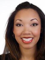 Young black woman with big smile braces upper teeth photo