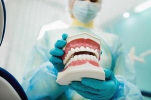 A model of a human jaw with teeth in the dentist's hand photo