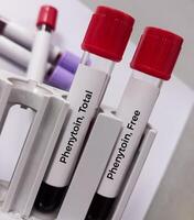 sangre muestra para fenitoína prueba, terapéutico droga, a mantener un terapéutico nivel y diagnosticar potencial para toxicidad foto