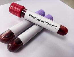 Blood sample for Phenytoin test, therapeutic drug, to maintain a therapeutic level and diagnose potential for toxicity photo