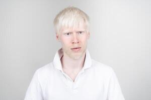 retrato de un albino hombre en estudio vestido camiseta aislado en un blanco antecedentes. anormal desviaciones raro apariencia foto