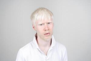 retrato de un albino hombre en estudio vestido camiseta aislado en un blanco antecedentes. anormal desviaciones raro apariencia foto