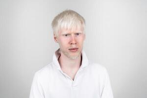 retrato de un albino hombre en estudio vestido camiseta aislado en un blanco antecedentes. anormal desviaciones raro apariencia foto