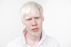 retrato de un albino hombre en estudio vestido camiseta aislado en un blanco antecedentes. anormal desviaciones raro apariencia foto