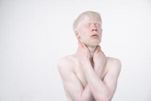 retrato de un albino hombre en estudio vestido camiseta aislado en un blanco antecedentes. anormal desviaciones raro apariencia foto