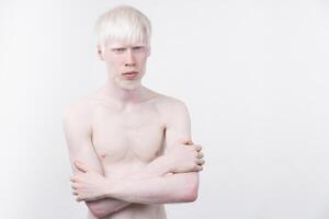 portrait of an albino man in  studio dressed t-shirt isolated on a white background. abnormal deviations. unusual appearance photo