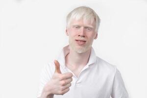 retrato de un albino hombre en estudio vestido camiseta aislado en un blanco antecedentes. anormal desviaciones raro apariencia foto